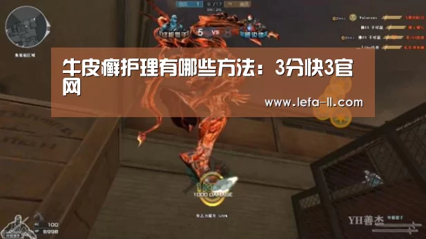 牛皮癣护理有哪些方法：3分快3官网